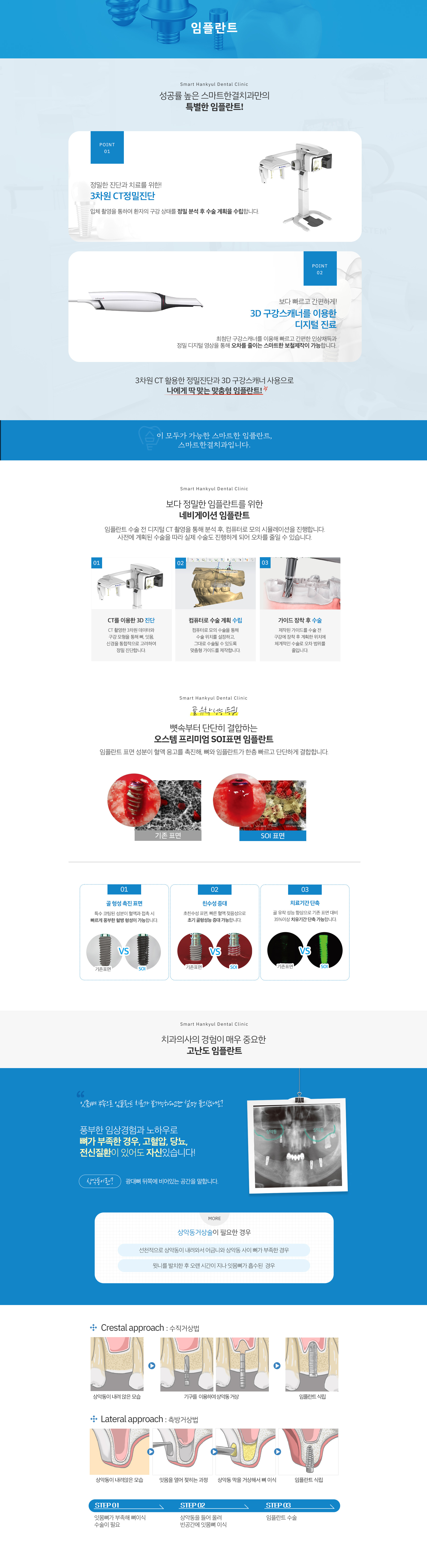 임플란트